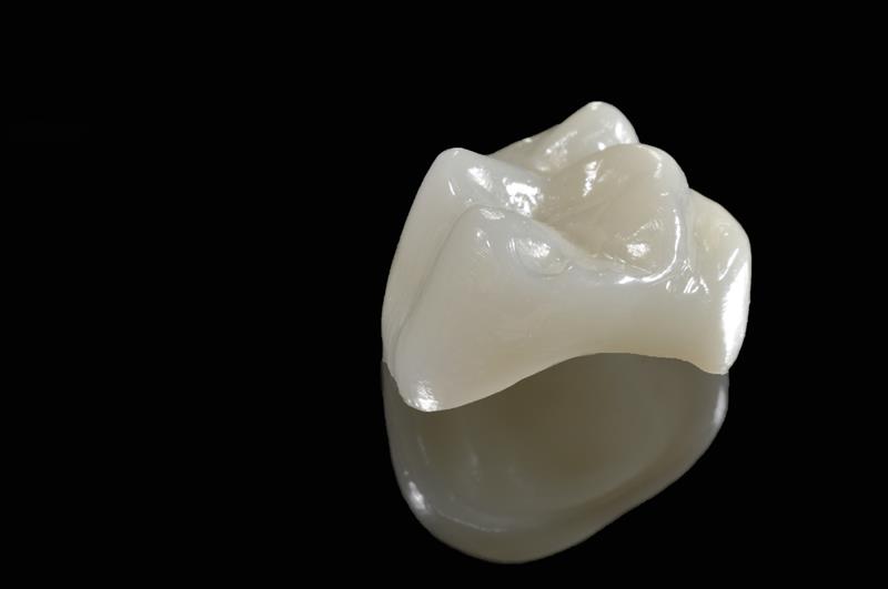 Porcelain Crowns Baja California, Mexico